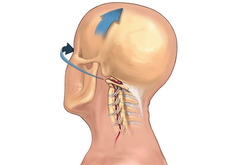 kaklo traškėjimas sukant galvą kaip gimdos kaklelio osteochondrozės simptomas
