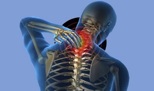 kaklo stuburo osteochondrozės priežastys